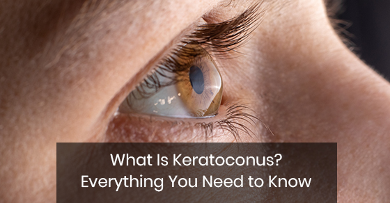 What Is Keratoconus? Everything You Need to Know