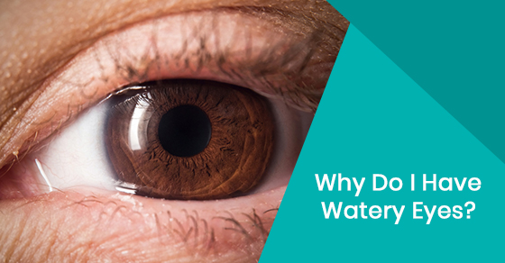 Why Do I Have Watery Eyes?